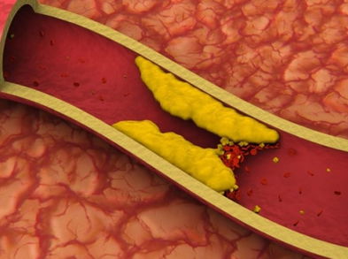 ¿Qué es el colesterol y qué alimentos nos ayudan a controlarlo?