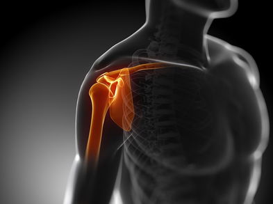 Cómo es nuestro hombro por dentro y sus lesiones más frecuentes