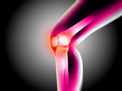 Crujido de las articulaciones, ¿perjudicial o indiferente?