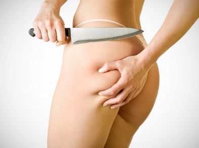 5 cosas que puedes hacer para reducir tu celulitis