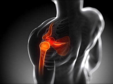 Lesiones más frecuentes y cómo prevenir el dolor de hombro