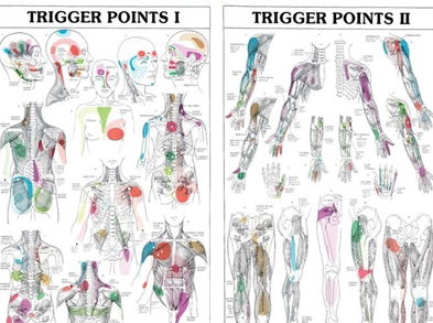 Cuidado con los puntos gatillo. ¿Sabías que ellos pueden estar detrás de tu lesión?