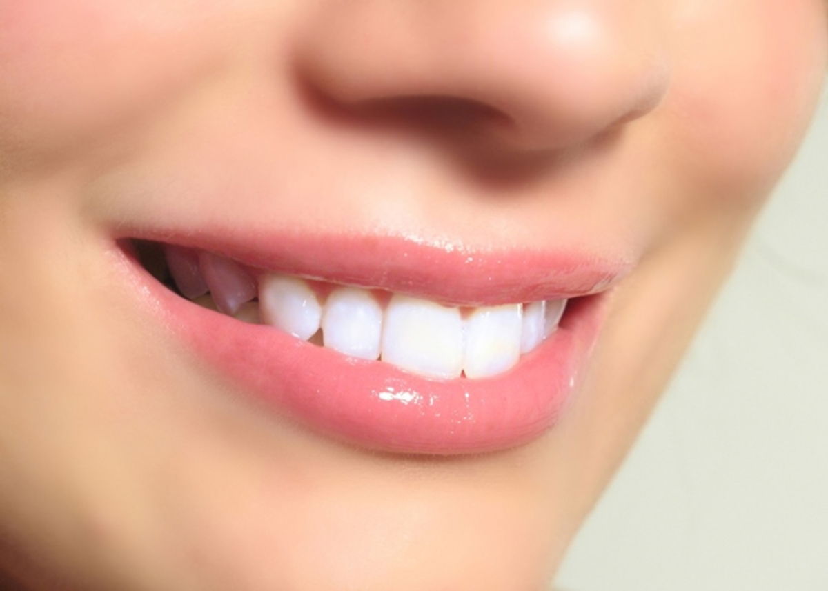 Dientes sanos