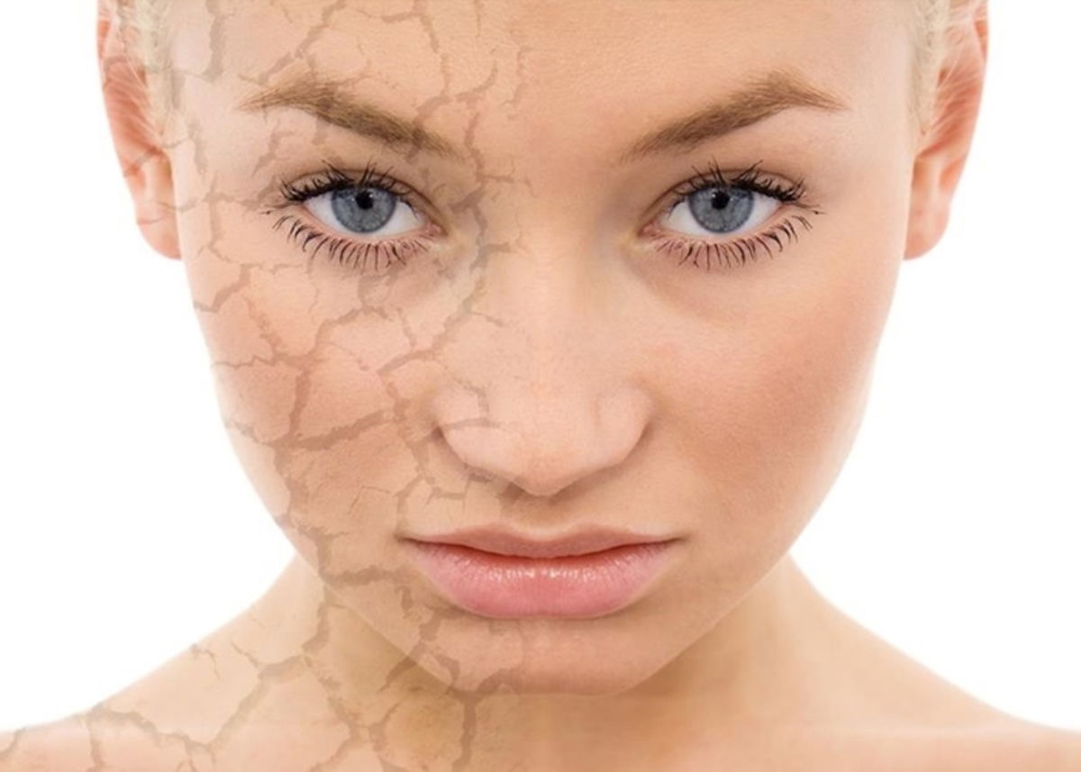 Mujer con piel seca