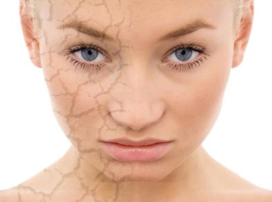 8 razones por las que seguimos con la piel seca