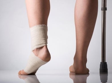 Recupérate de un esguince de tobillo con estos ejercicios