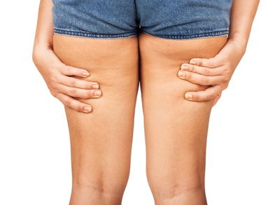 Cuáles son los mejores ejercicios para perder la celulitis
