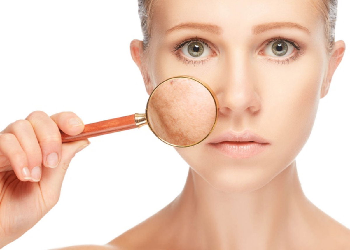Cremas manchas rostro