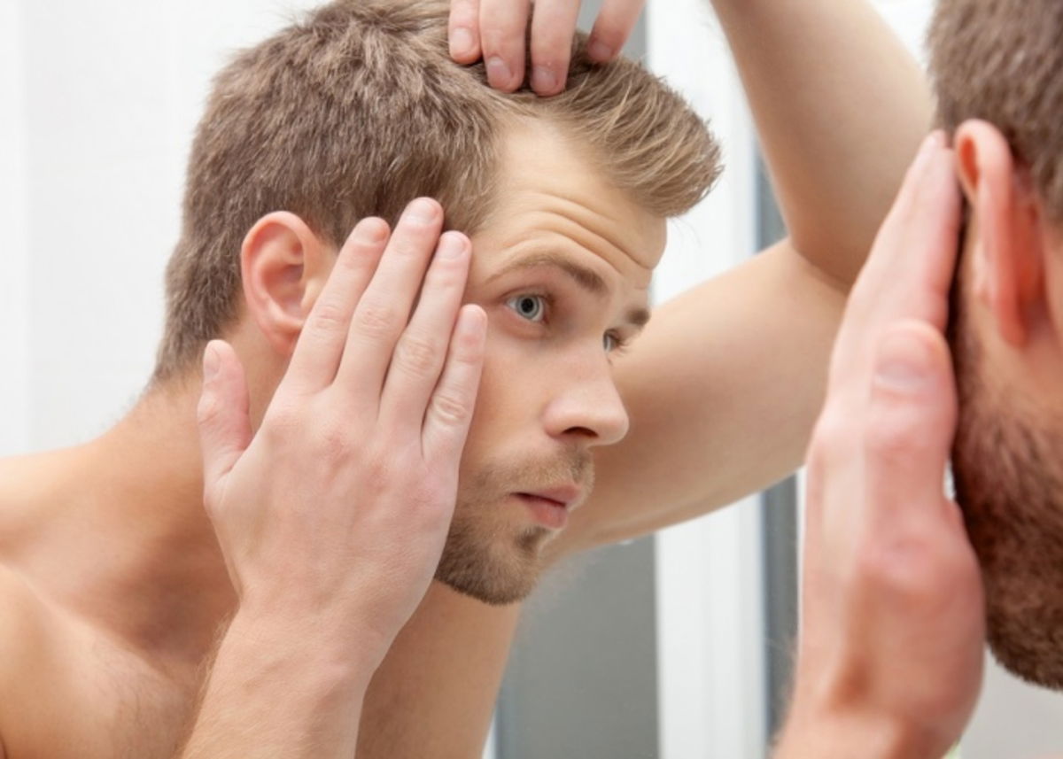 Caída de cabello