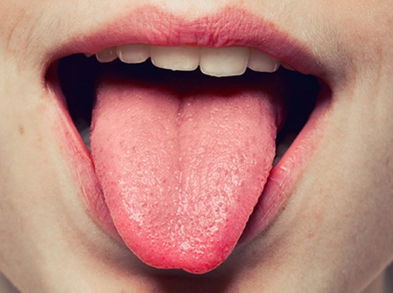 Remedios naturales para la pérdida del sentido del gusto