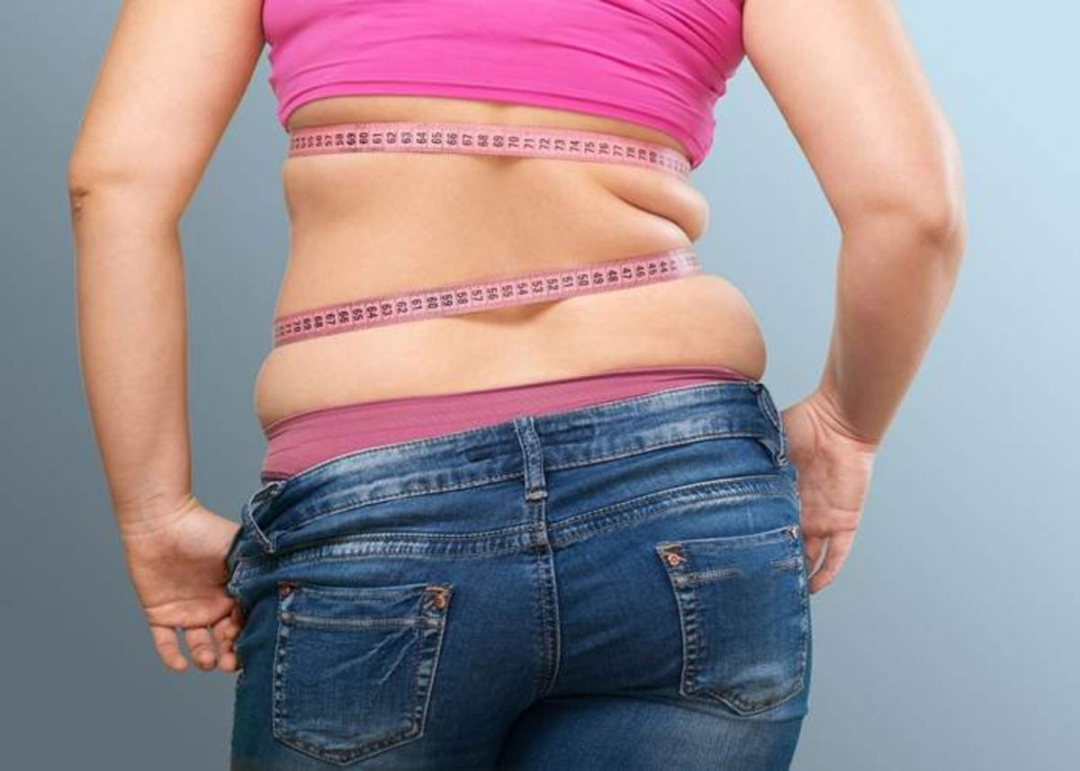 Persona con exceso de grasa