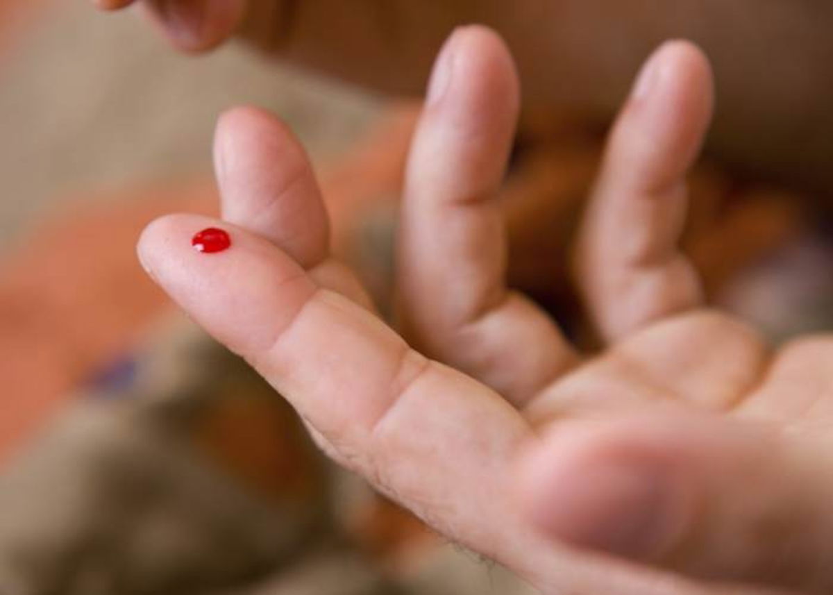 Dedo con sangre