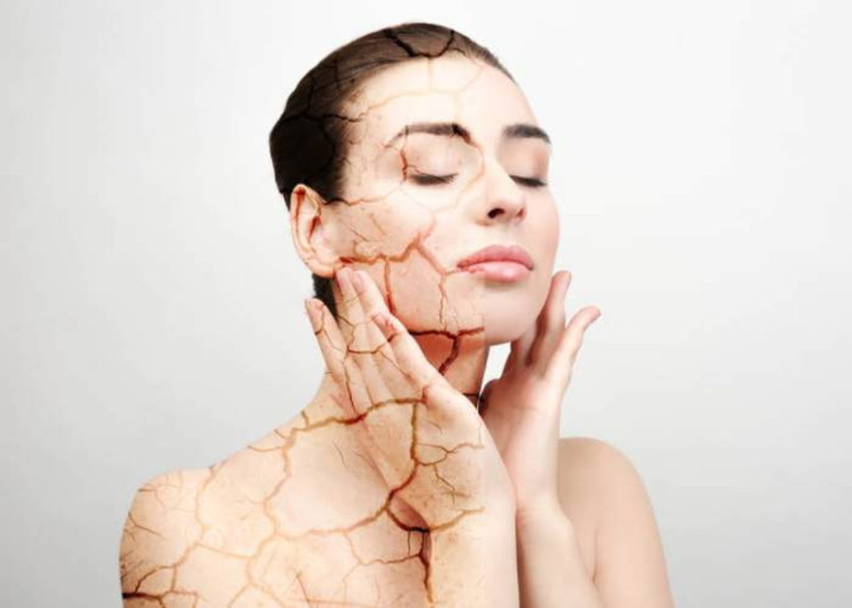 Mujer piel seca