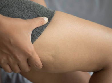 Lucha contra la celulitis con estos entrenamientos