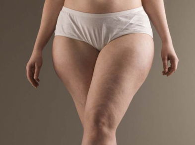 Deshazte de la celulitis con estos hábitos matutinos