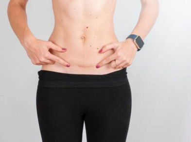 Fortalece el abdomen después de una cesárea con estos ejercicios