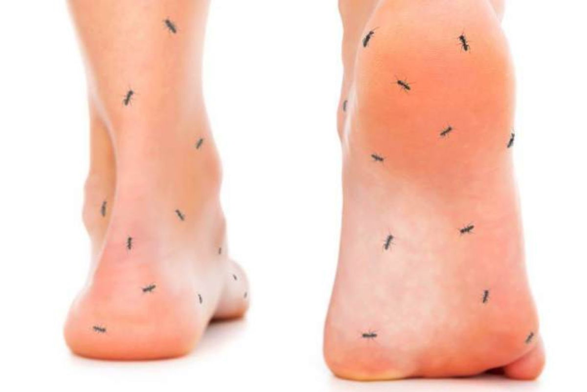 Piernas con hormigueo