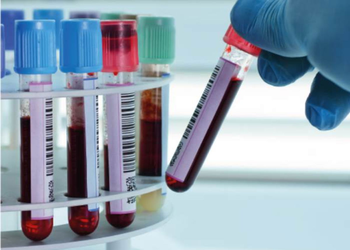 Mano con tubo sangre