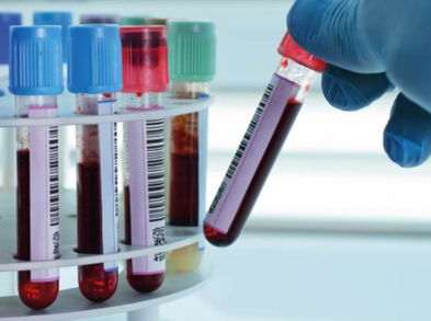 Alimentos que funcionan como anticoagulantes naturales