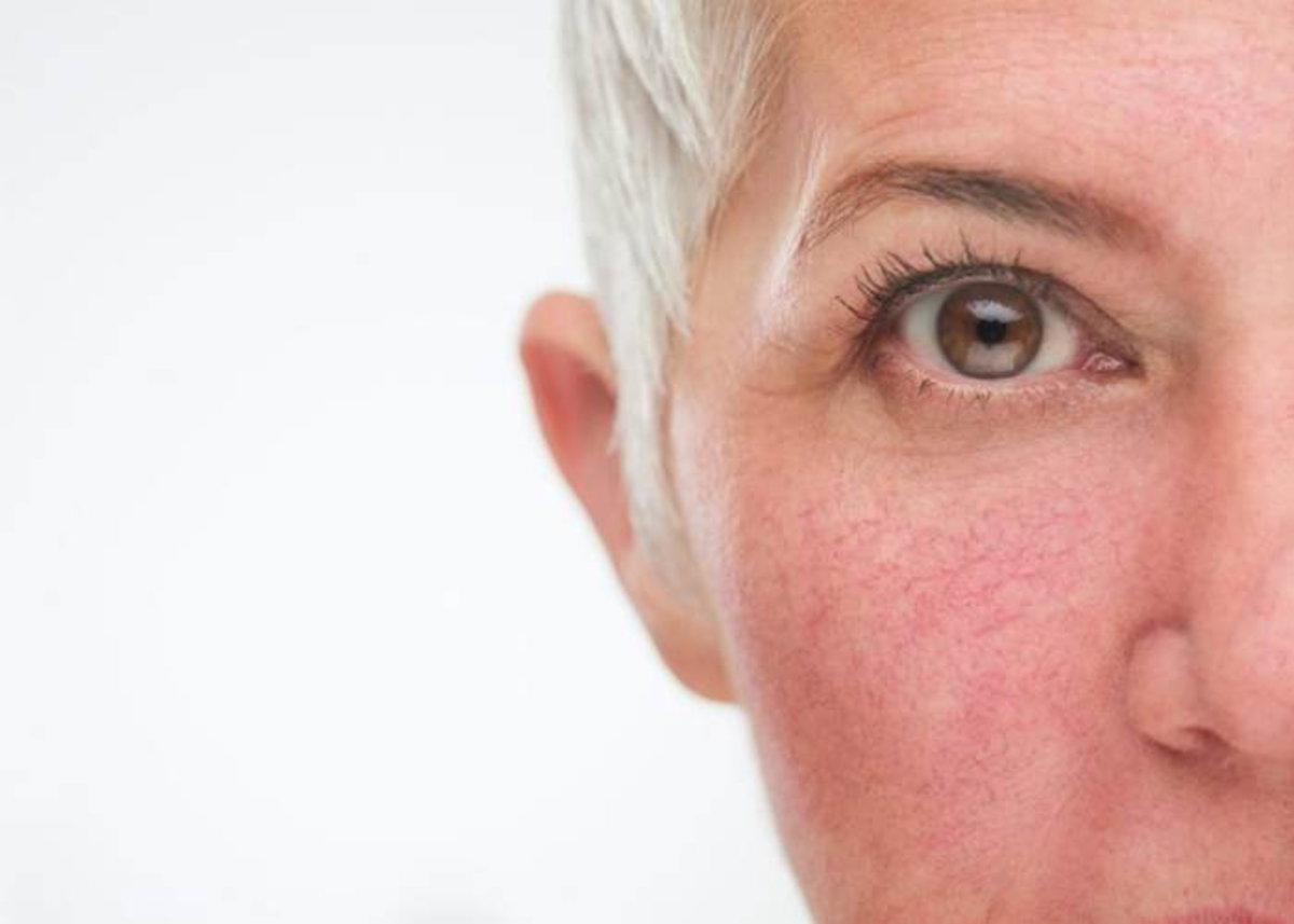 Cómo Eliminar Manchas y Rojeces de la Cara: Guía Completa