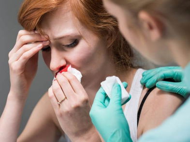 Remedios naturales para la hemorragia nasal