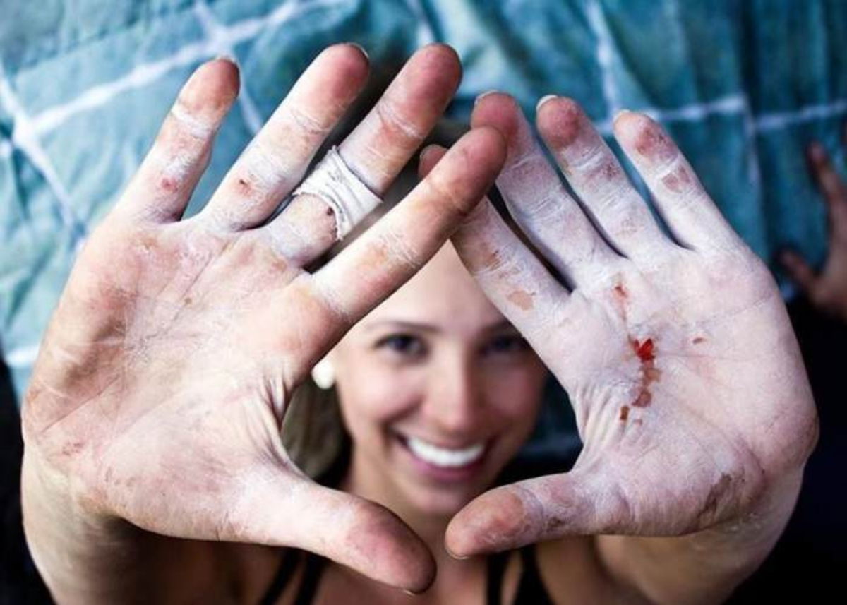 Mujer manos heridas