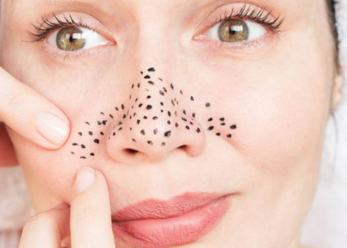 Mujer aprentando puntos negros