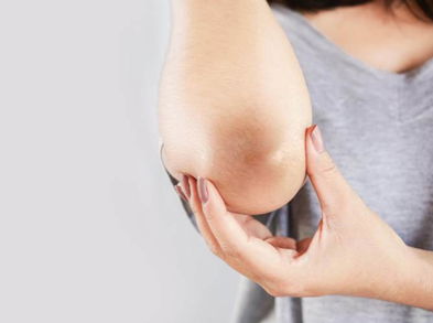 Remedios caseros para acabar con los codos resecos