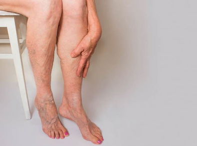 Ejercicios para evitar trombos en las piernas