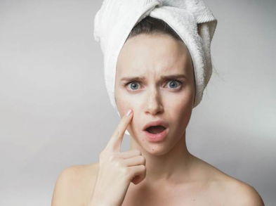 Trata el acné con frutas ¡Prueba de inmediato!