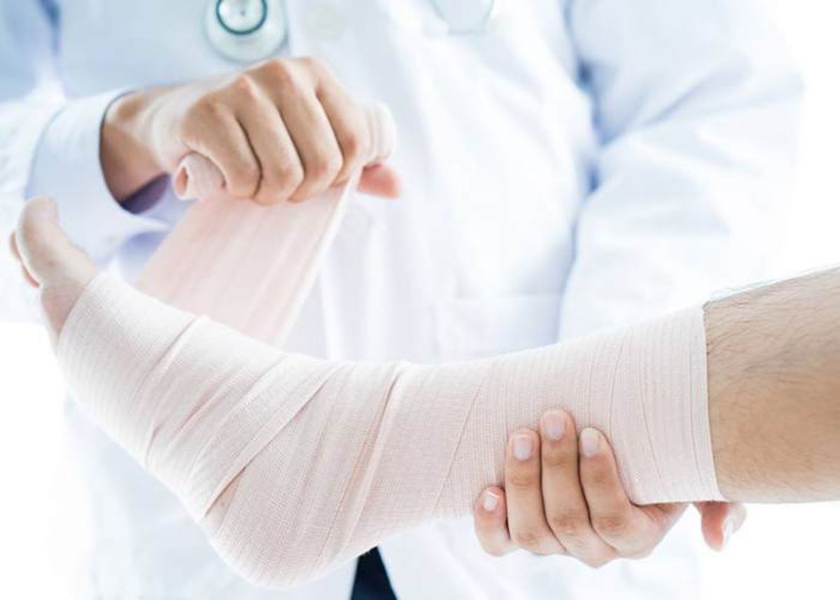 Persona con fractura hueso