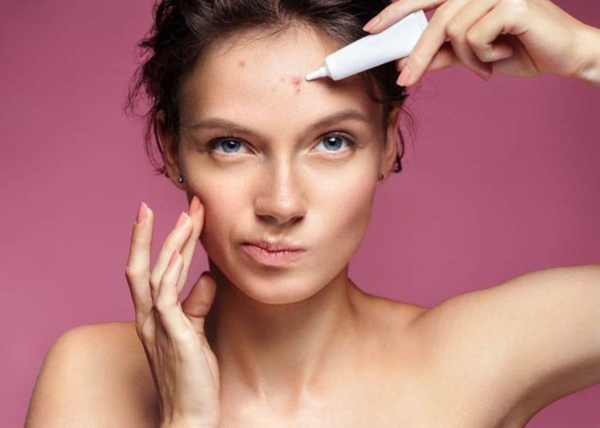 Mujer con grano en la frente