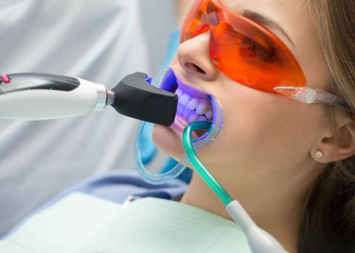 Mujer blanqueamiento dental