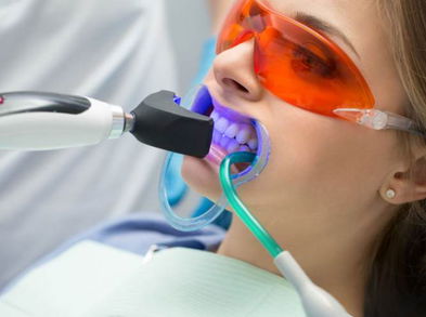 Riesgos del blanqueamiento dental