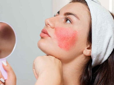 Síntomas que indican alergia al maquillaje ¡Vayamos a conocerlos!