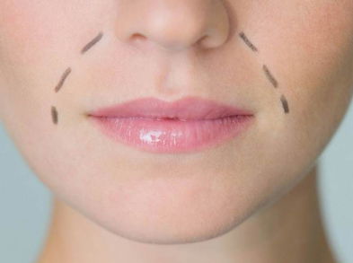 Masajes para acabar con los surcos nasogenianos