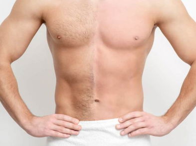 Cuáles son las ventajas de la depilación masculina