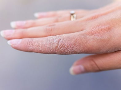 Dile adiós a las manos resecas con estos tratamientos caseros