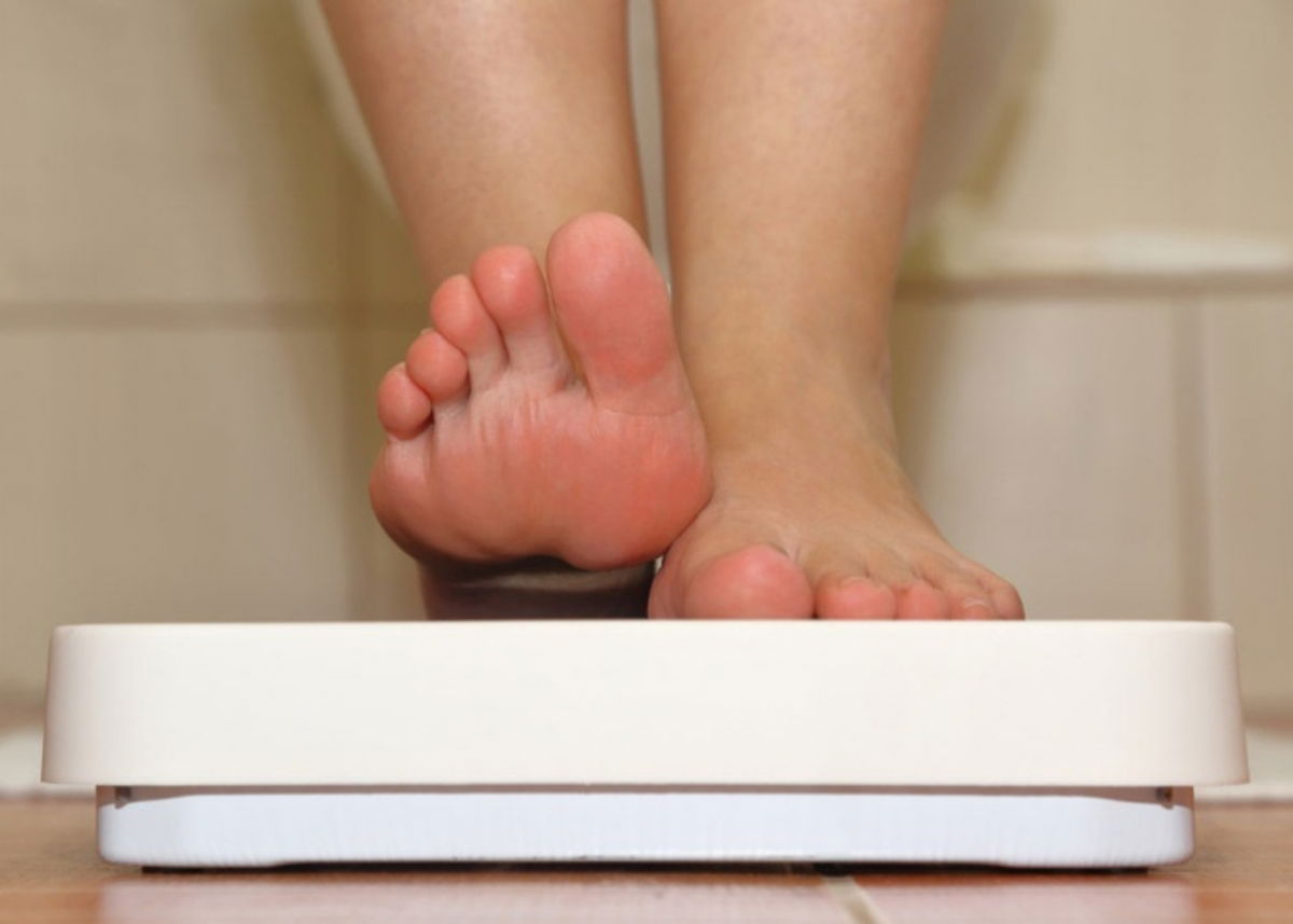 Pies de persona con obesidad